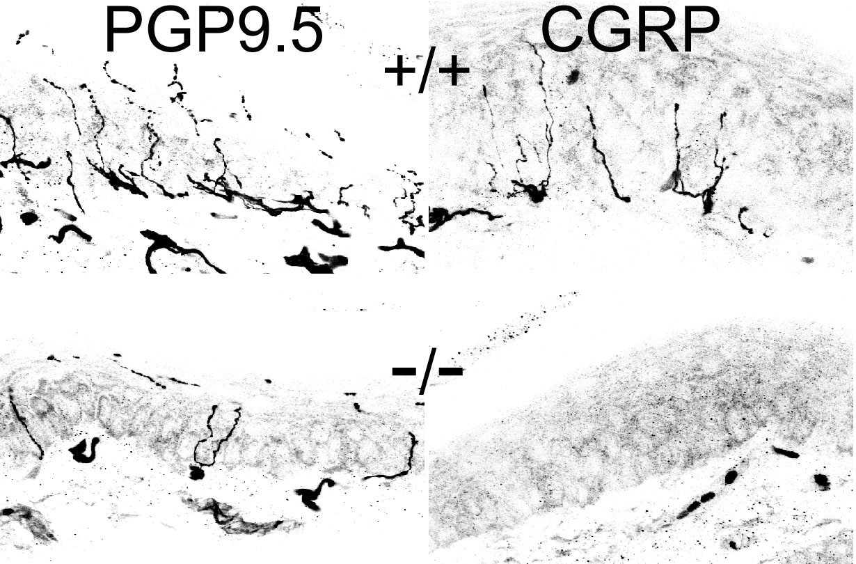 NGF and skin innervation